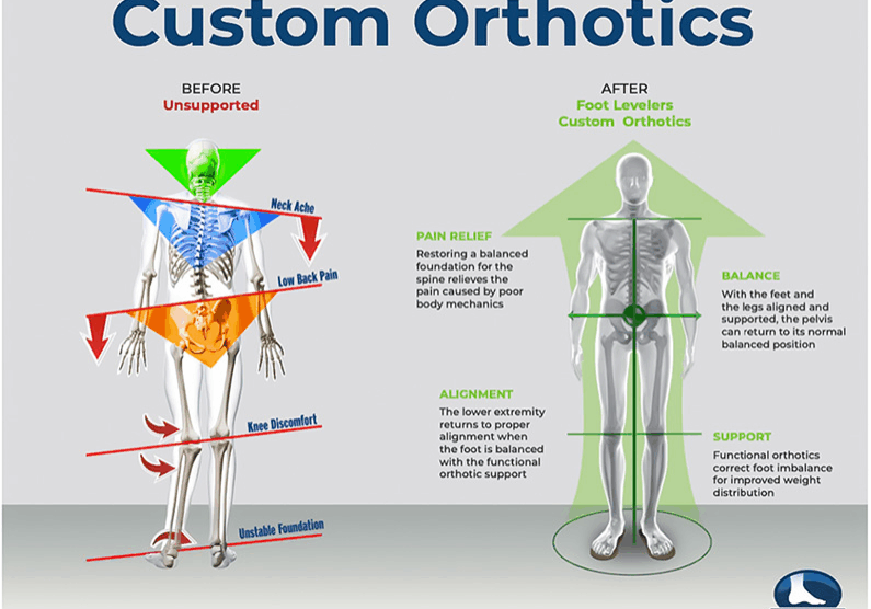 Foot Levelers Orthotics
